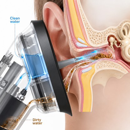 Torrexa AquaClean Ear Wax Care System
